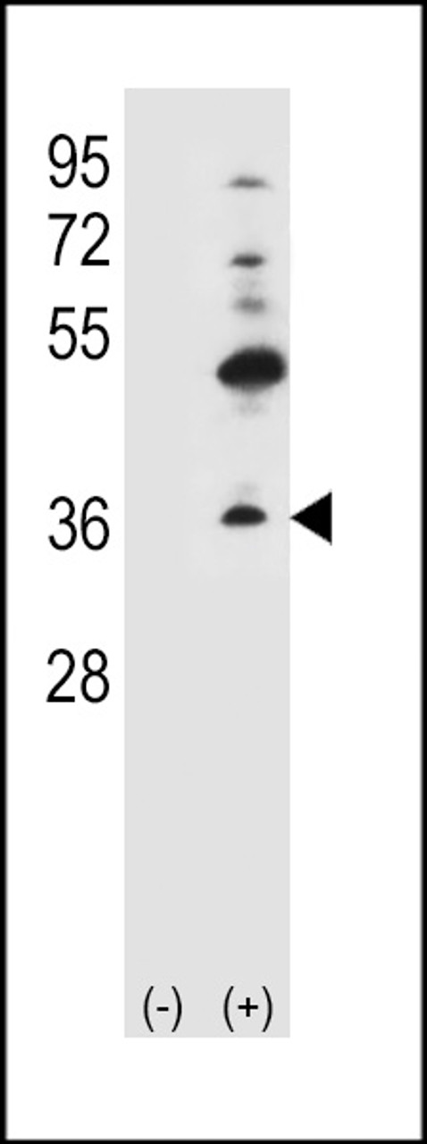Western blot analysis of GJB4 using rabbit polyclonal GJB4 Antibody (H105.Connexin) using 293 cell lysates (2 ug/lane) either nontransfected (Lane 1) or transiently transfected (Lane 2) with the GJB4 gene.