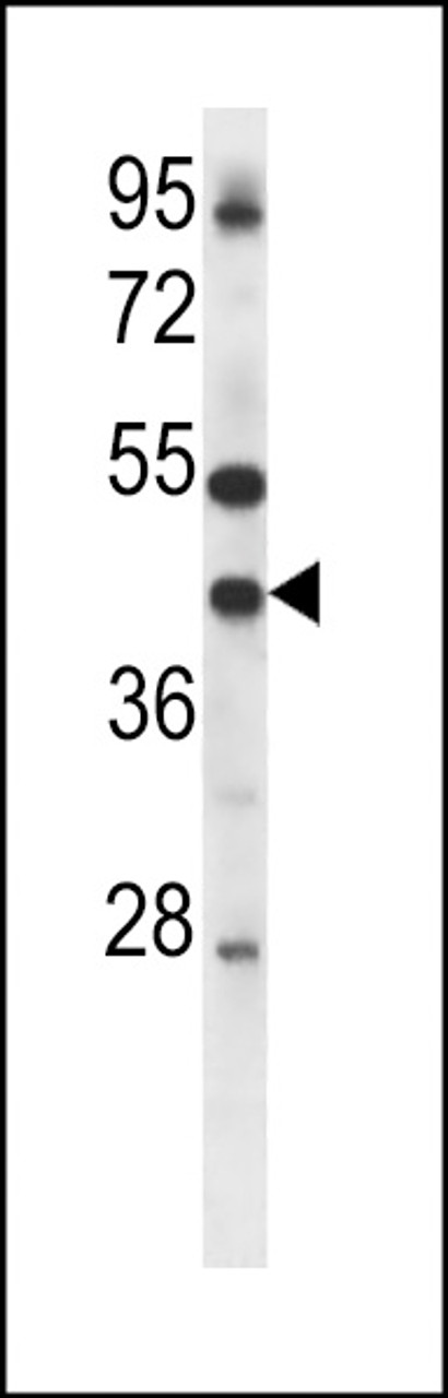 Western blot analysis in mouse lung tissue lysates (35ug/lane) .This demonstrates the GJA4 antibody detected the GJA4 protein (arrow) .
