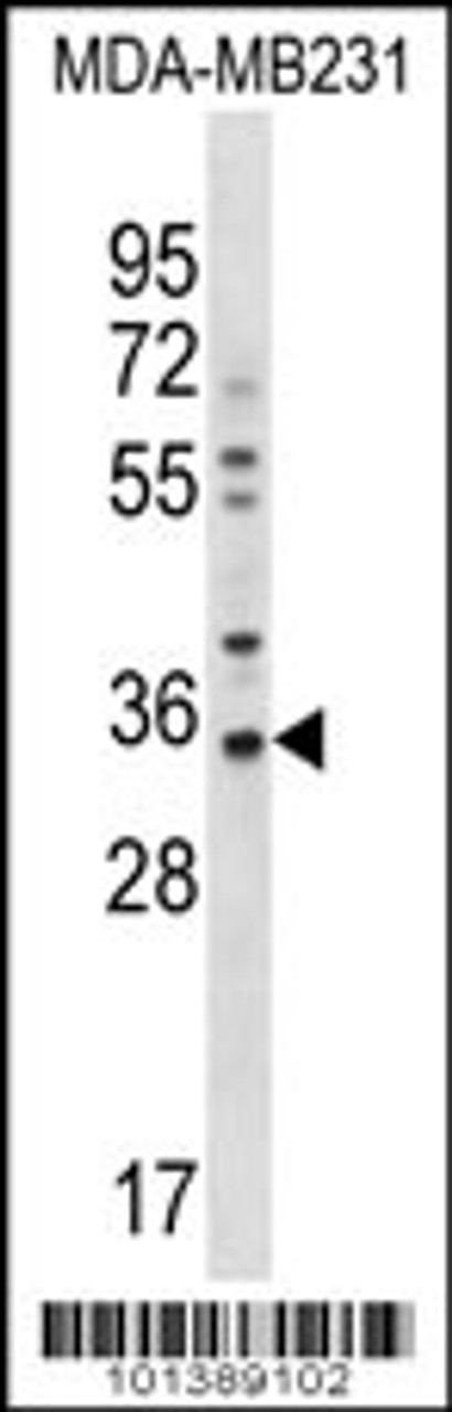 Western blot analysis in MDA-MB231 cell line lysates (35ug/lane) .This demonstrates the GJB5 antibody detected the GJB5 protein (arrow) .