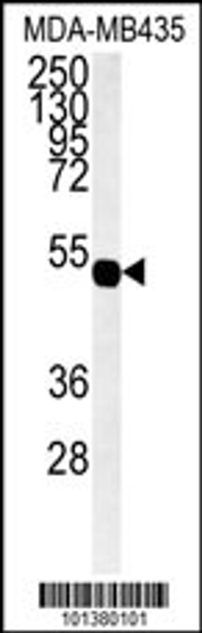 Western blot analysis of hGJA7-H104.Connexin in MDA-MB435 cell line lysates (35ug/lane)