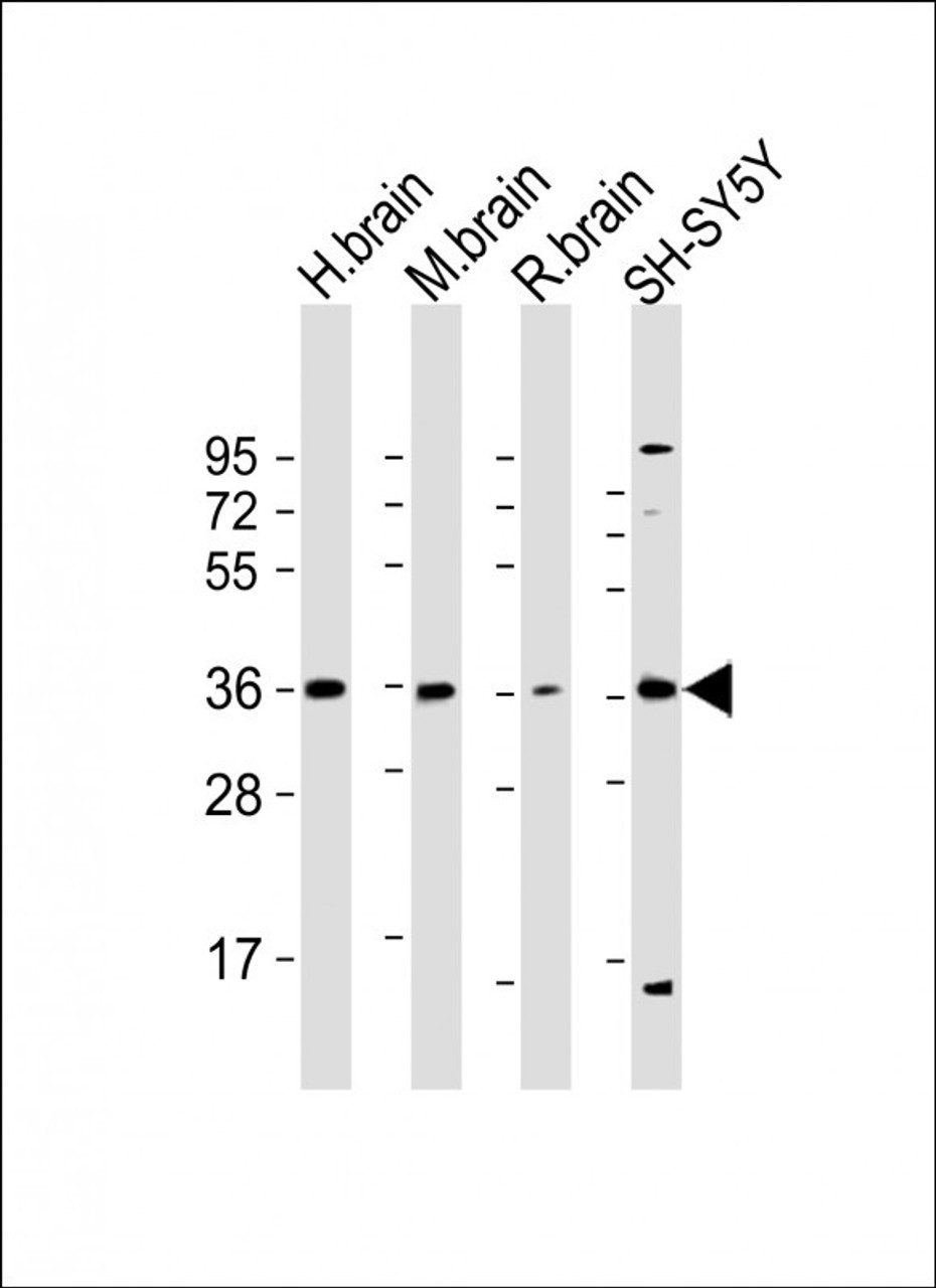 Western Blot at 1:2000 dilution Lane 1: human brain lysate Lane 2: mouse brain lysate Lane 3: rat brain lysate Lane 4: SH-SY5Y whole cell lysate Lysates/proteins at 20 ug per lane.