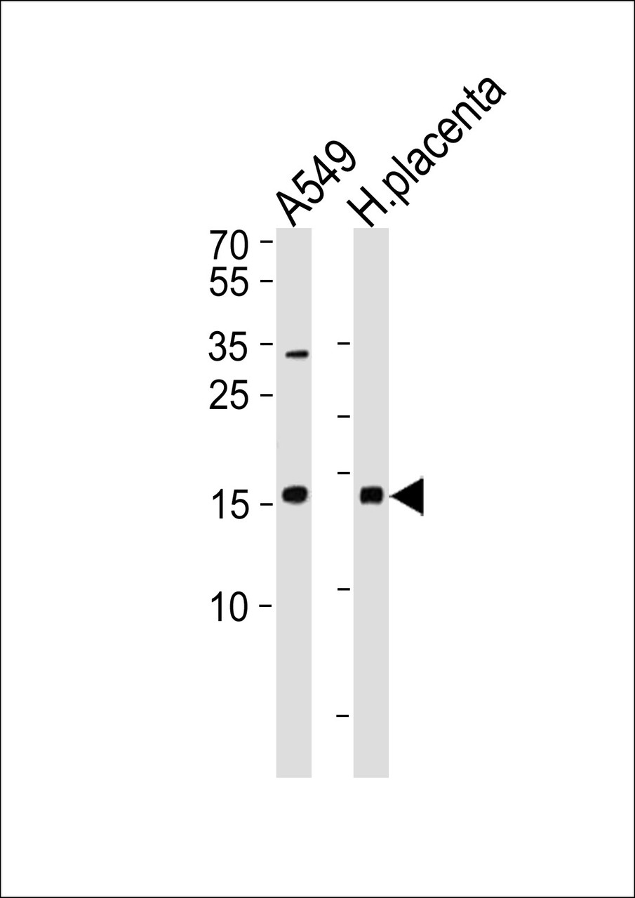 Western blot analysis in A549 cell line and human placenta lysates (35ug/lane) .