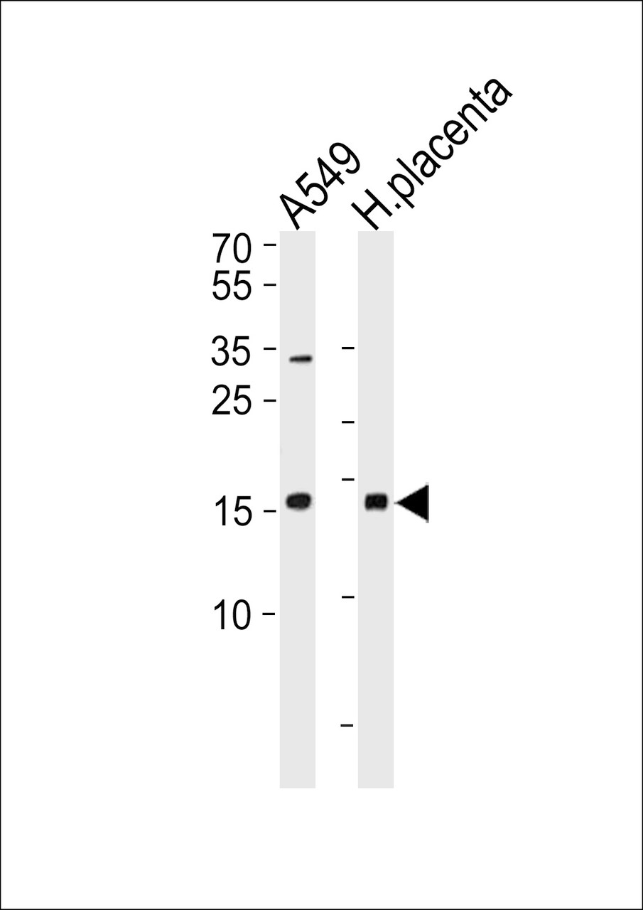 Western blot analysis in A549 cell line and human placenta lysates (35ug/lane) .