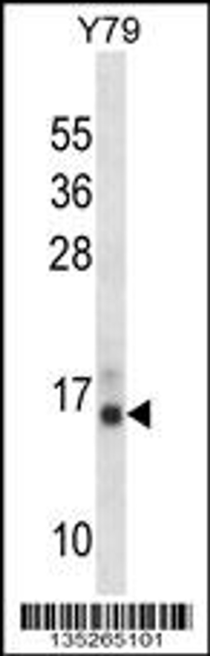 Western blot analysis in Y79 cell line lysates (35ug/lane) .