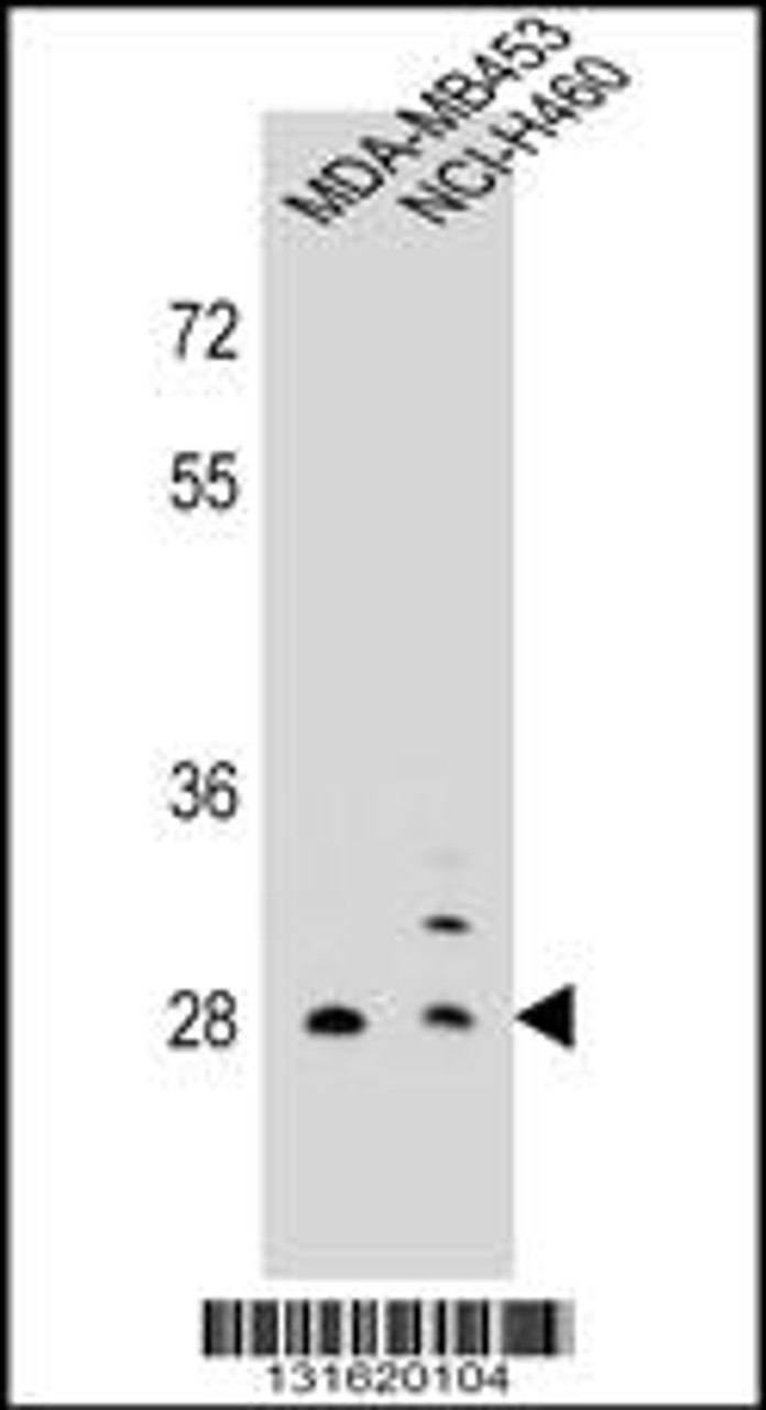 Western blot analysis in MDA-MB453, NCI-H460 cell line lysates (35ug/lane) .