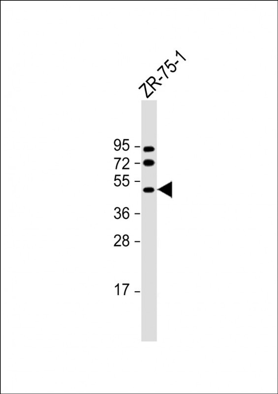 Western Blot at 1:2000 dilution + ZR-75-1 whole cell lysate Lysates/proteins at 20 ug per lane.