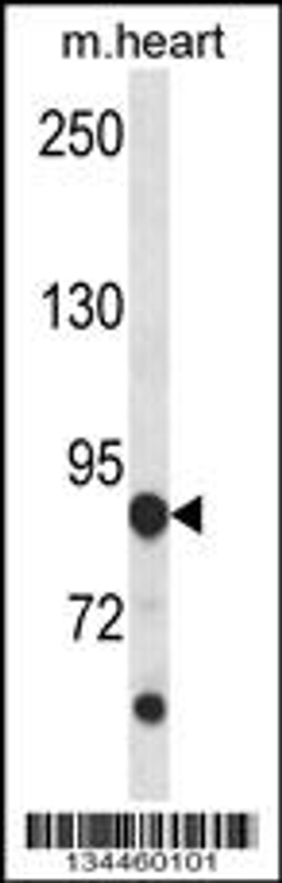 Western blot analysis in mouse heart tissue lysates (35ug/lane) .