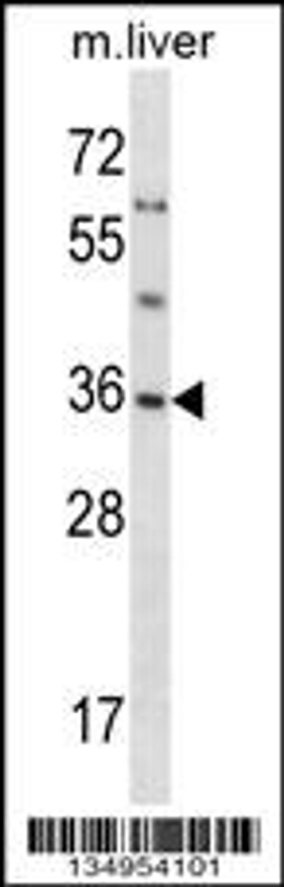 Western blot analysis in mouse liver tissue lysates (35ug/lane) .