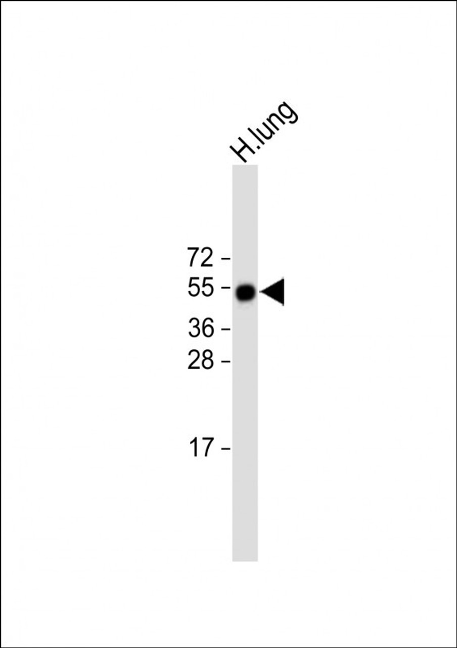 Western Blot at 1:2000 dilution + human lung lysate Lysates/proteins at 20 ug per lane.