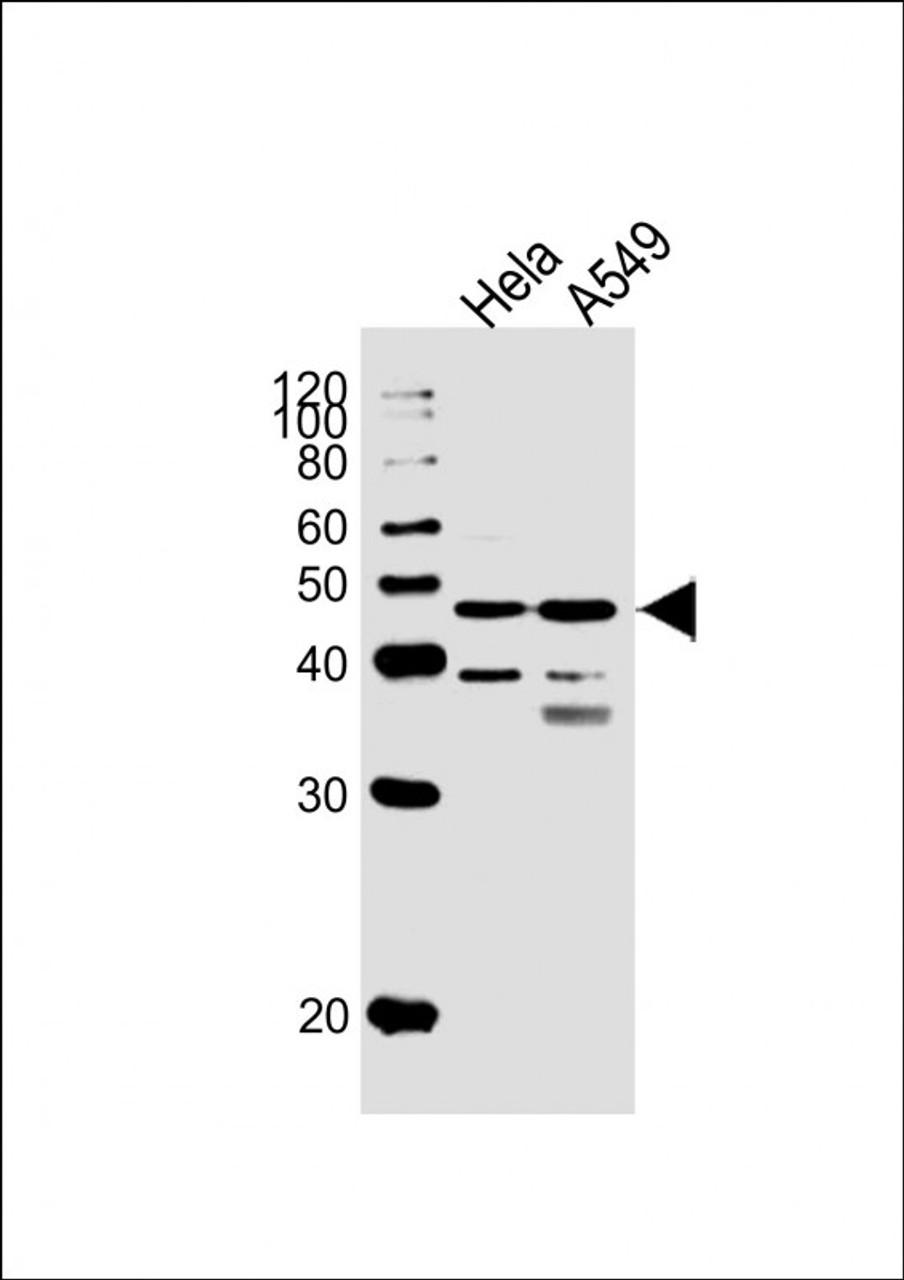 Western Blot at 1:1000 dilution Lane 1: Hela whole cell lysates Lane 2: A549 whole cell lysates Lysates/proteins at 20 ug per lane.