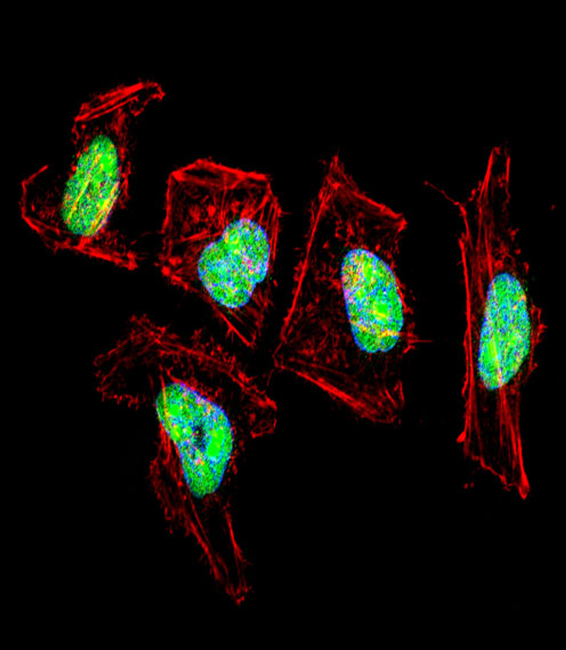 Fluorescent confocal image of Hela cell stained with NFIC Antibody . Hela cells were fixed with 4% PFA (20 min) , permeabilized with Triton X-100 (0.1%, 10 min) , then incubated with NFIC primary antibody (1:25) . For secondary antibody, Alexa Fluor 488 conjugated donkey anti-rabbit antibody (green) was used (1:400) .Cytoplasmic actin was counterstained with Alexa Fluor 555 (red) conjugated Phalloidin (7units/ml) . Nuclei were counterstained with DAPI (blue) (10 ug/ml, 10 min) . NFIC immunoreactivity is localized to nucleus significantly.