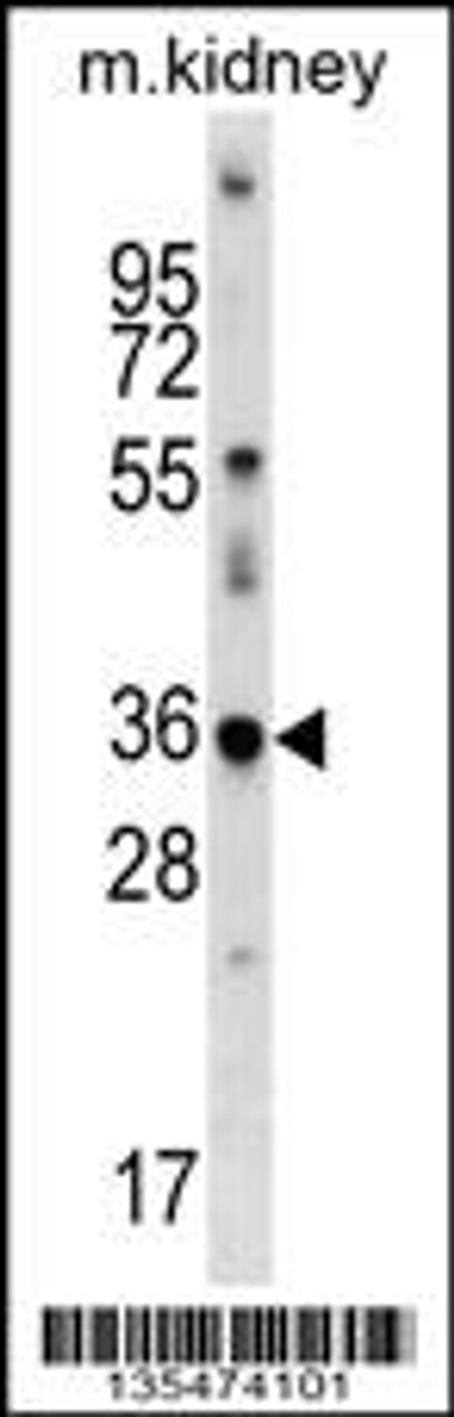 Western blot analysis in mouse kidney tissue lysates (35ug/lane) .