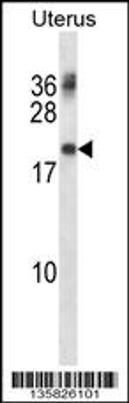 Western blot analysis in human normal Uterus tissue lysates (35ug/lane) .