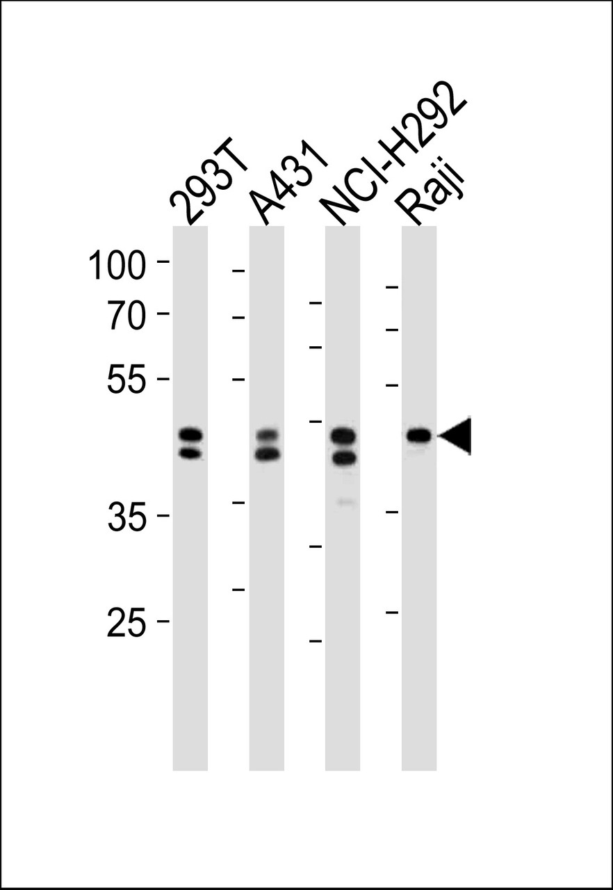 Western blot analysis in 293T, A431, NCI-H292, Raji cell line lysates (35ug/lane) .