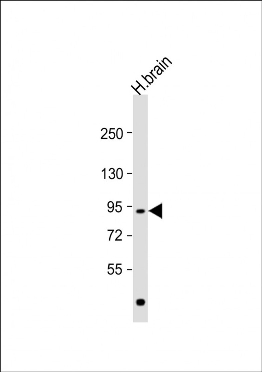 Western Blot at 1:1000 dilution + human brain lysate Lysates/proteins at 20 ug per lane.