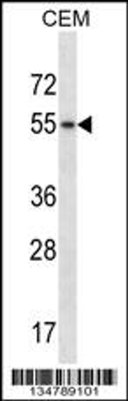 Western blot analysis in CEM cell line lysates (35ug/lane) .This demonstratedetected the Hck protein (arrow) .