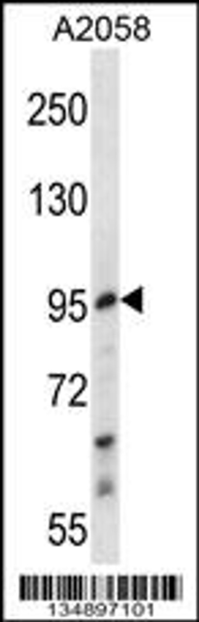 Western blot analysis in A2058 cell line lysates (35ug/lane) .