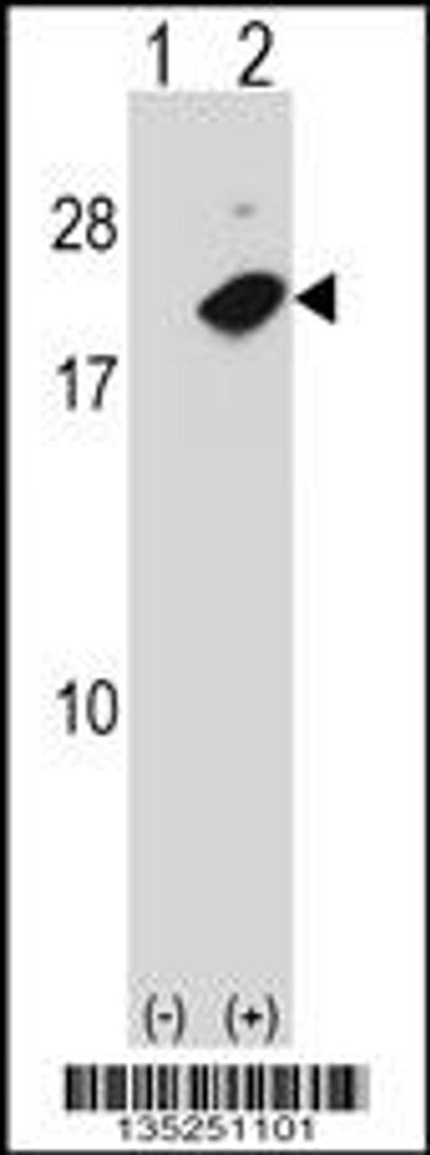 Western blot analysis of NUDT2 using rabbit polyclonal NUDT2 Antibody using 293 cell lysates (2 ug/lane) either nontransfected (Lane 1) or transiently transfected (Lane 2) with the NUDT2 gene.