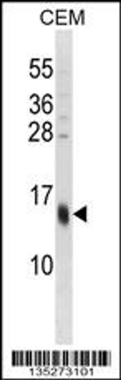 Western blot analysis in CEM cell line lysates (35ug/lane) .