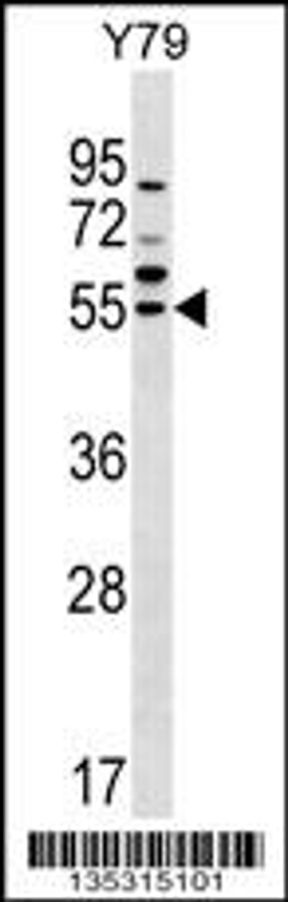 Western blot analysis in Y79 cell line lysates (35ug/lane) .