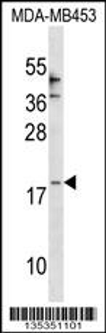 Western blot analysis in MDA-MB453 cell line lysates (35ug/lane) .