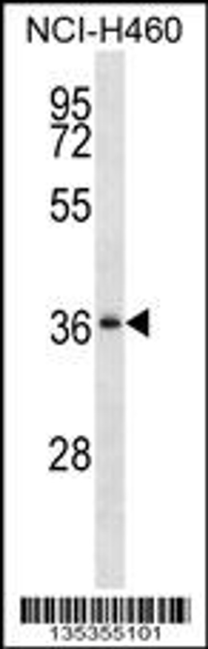 Western blot analysis in NCI-H460 cell line lysates (35ug/lane) .