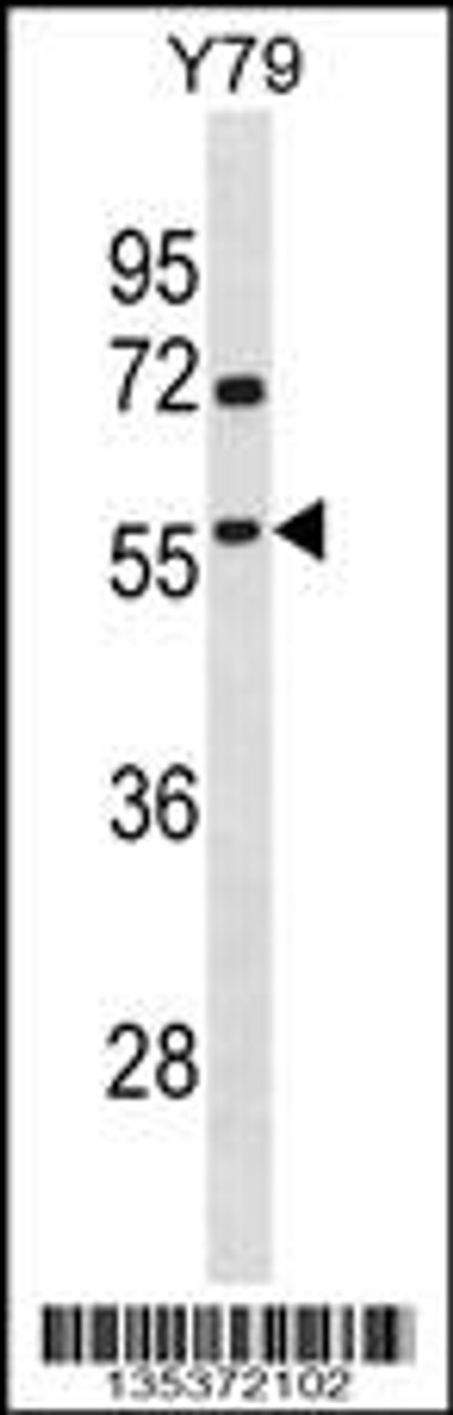 Western blot analysis in Y79 cell line lysates (35ug/lane) .