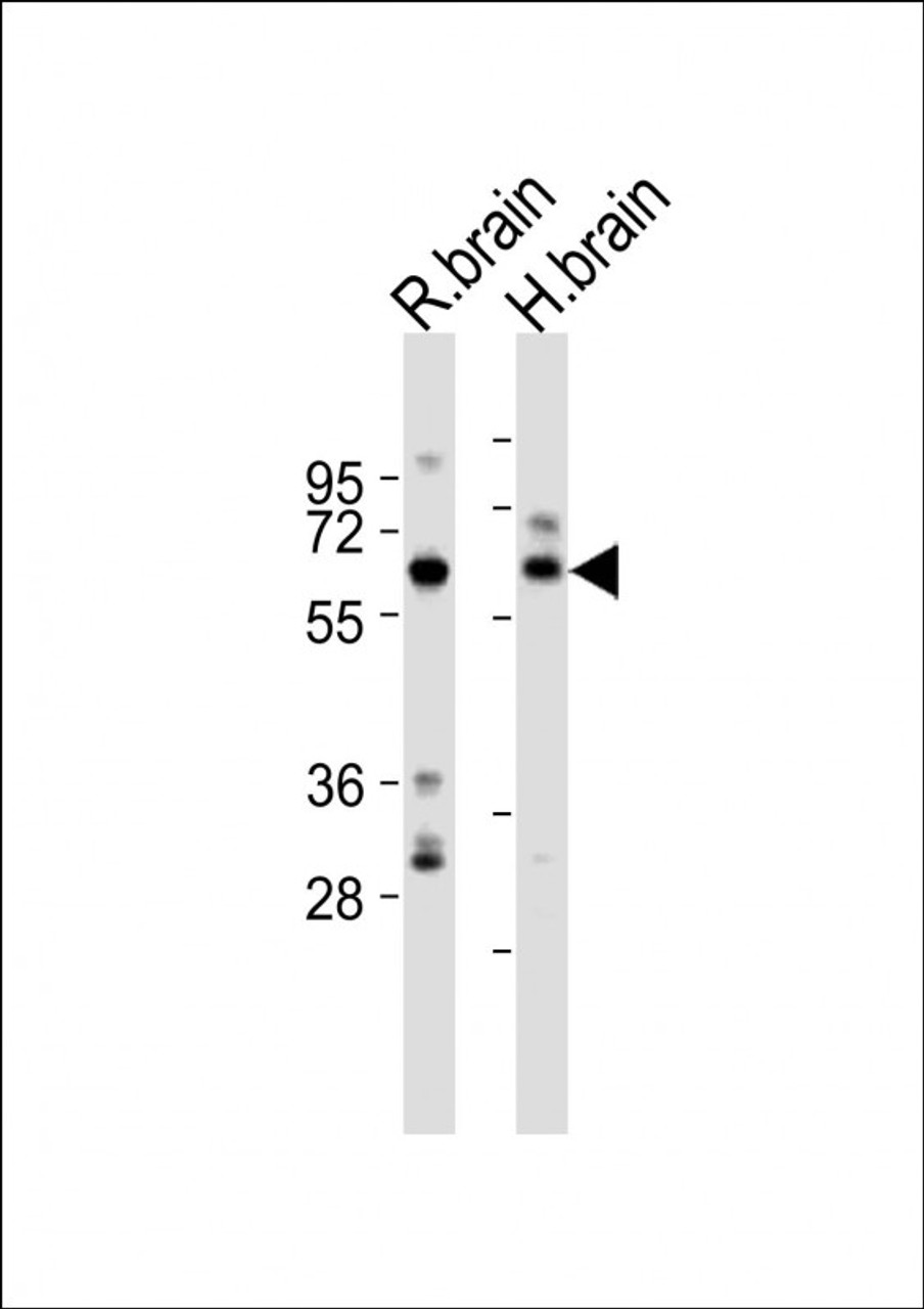 Western Blot at 1:2000 dilution Lane 1: rat brain lysates Lane 2: human brain lysates Lysates/proteins at 20 ug per lane.