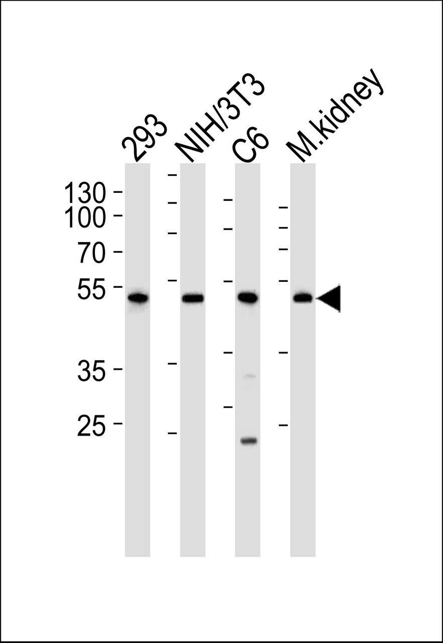 Western blot analysis of lysates from 293, mouse NIH/3T3, rat C6 cell line and mouse kidney tissue lysate (from left to right) , using Mouse Cdk9 Antibody at 1:1000 at each lane.