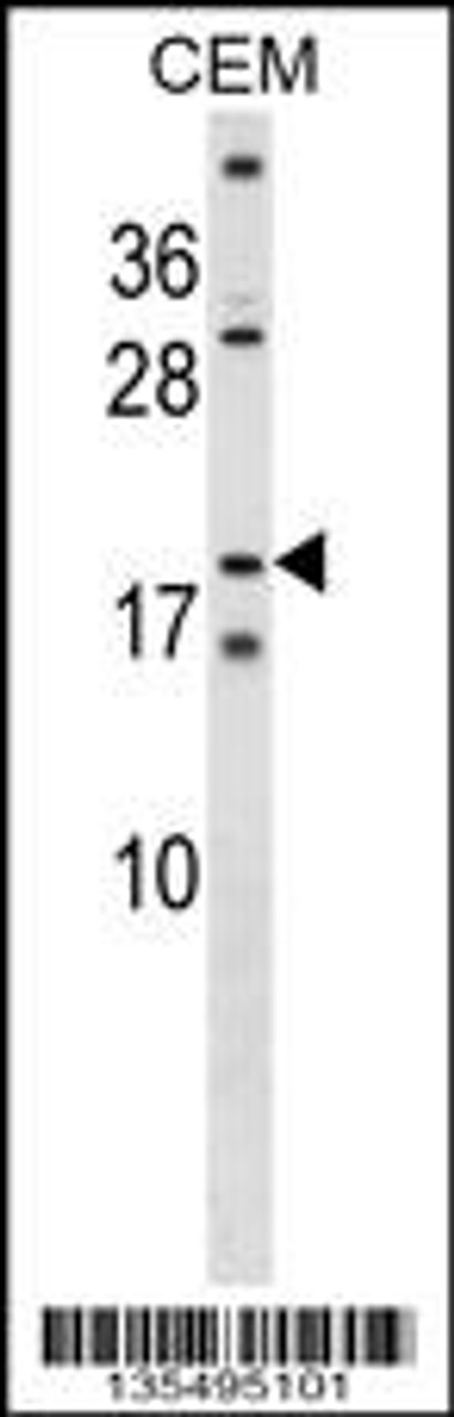 Western blot analysis in CEM cell line lysates (35ug/lane) .