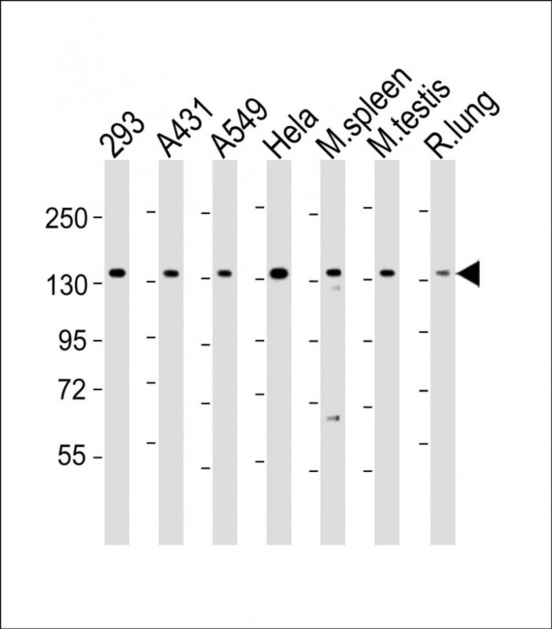 Western Blot at 1:2000 dilution Lane 1: 293 whole cell lysate Lane 2: A431 whole cell lysate Lane 3: A549 whole cell lysate Lane 4: Hela whole cell lysate Lane 5: mouse spleen lysate Lane 6: mouse testis lysate Lane 7: rat lung lysate Lysates/proteins at 20 ug per lane.