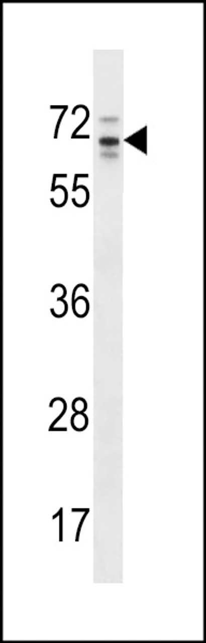 Western blot analysis in HepG2 cell line lysates (35ug/lane) .This demonstrates the RP13-102H20.1 antibody detected the RP13-102H20.1 protein (arrow) .