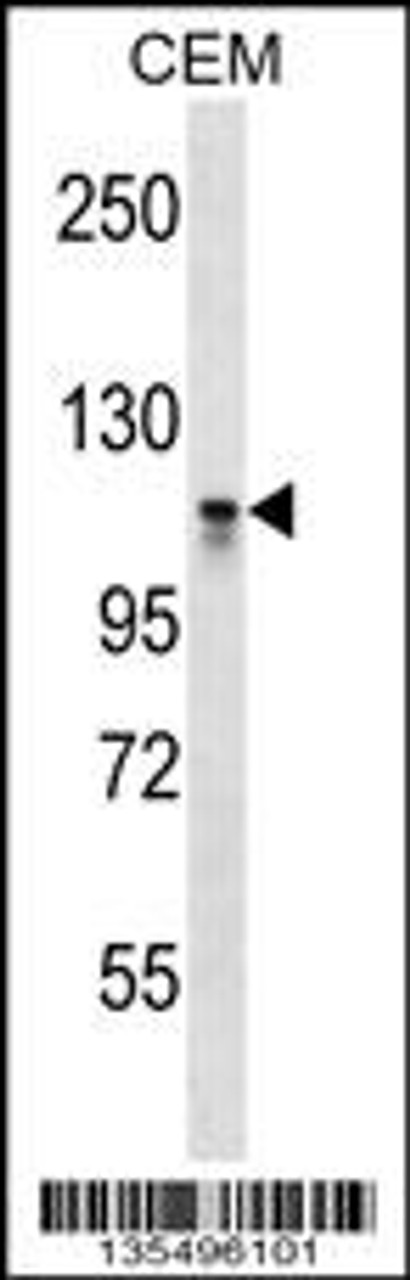 Western blot analysis in CEM cell line lysates (35ug/lane) .This demonstrates the DNMT3A antibody detected the DNMT3A protein (arrow) .