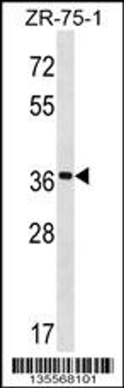 Western blot analysis in ZR-75-1 cell line lysates (35ug/lane) .
