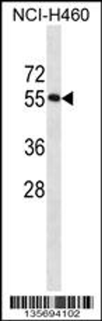 Western blot analysis in NCI-H460 cell line lysates (35ug/lane) .