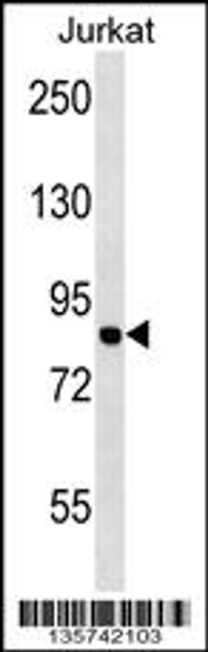 Western blot analysis in Jurkat cell line lysates (35ug/lane) .