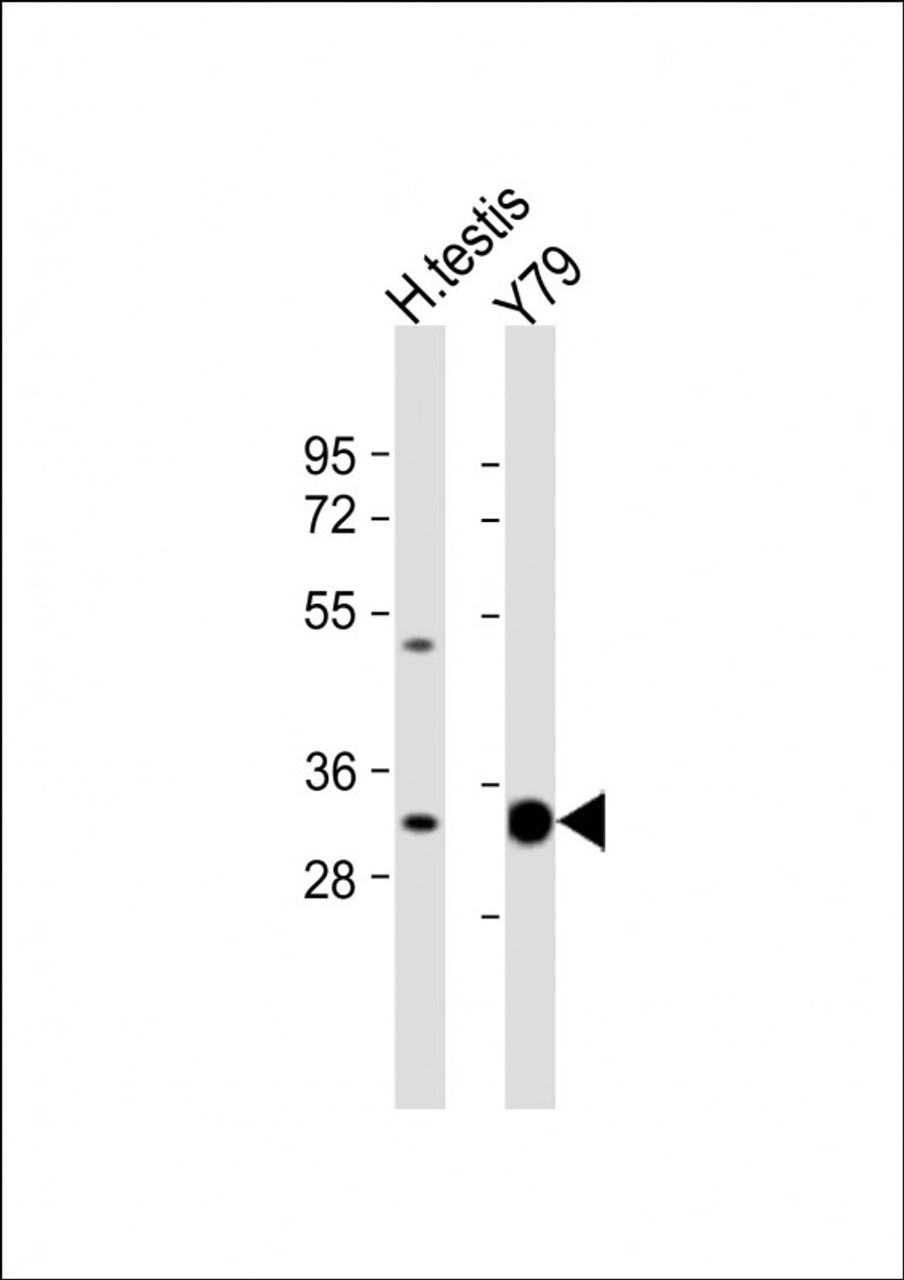 Western Blot at 1:1000 dilution Lane 1: human testis lysate Lane 2: Y79 whole cell lysate Lysates/proteins at 20 ug per lane.