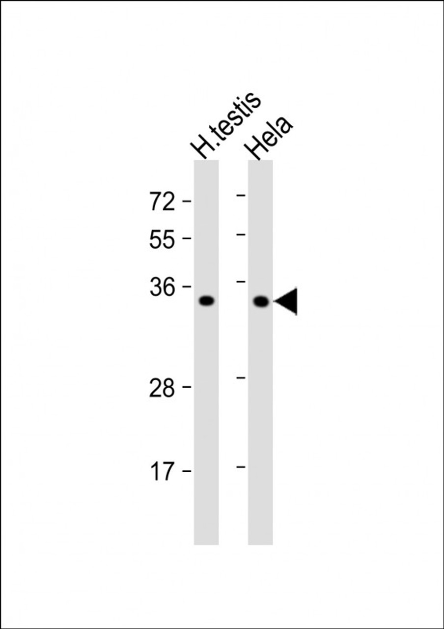 Western Blot at 1:1000 dilution Lane 1: human testis lysate Lane 2: Hela whole cell lysate Lysates/proteins at 20 ug per lane.