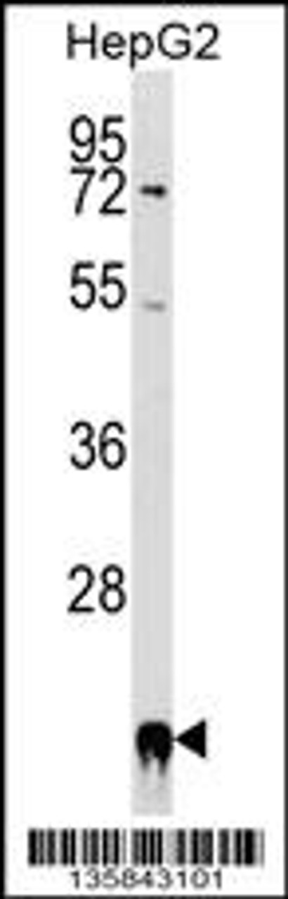 Western blot analysis in HepG2 cell line lysates (35ug/lane) .