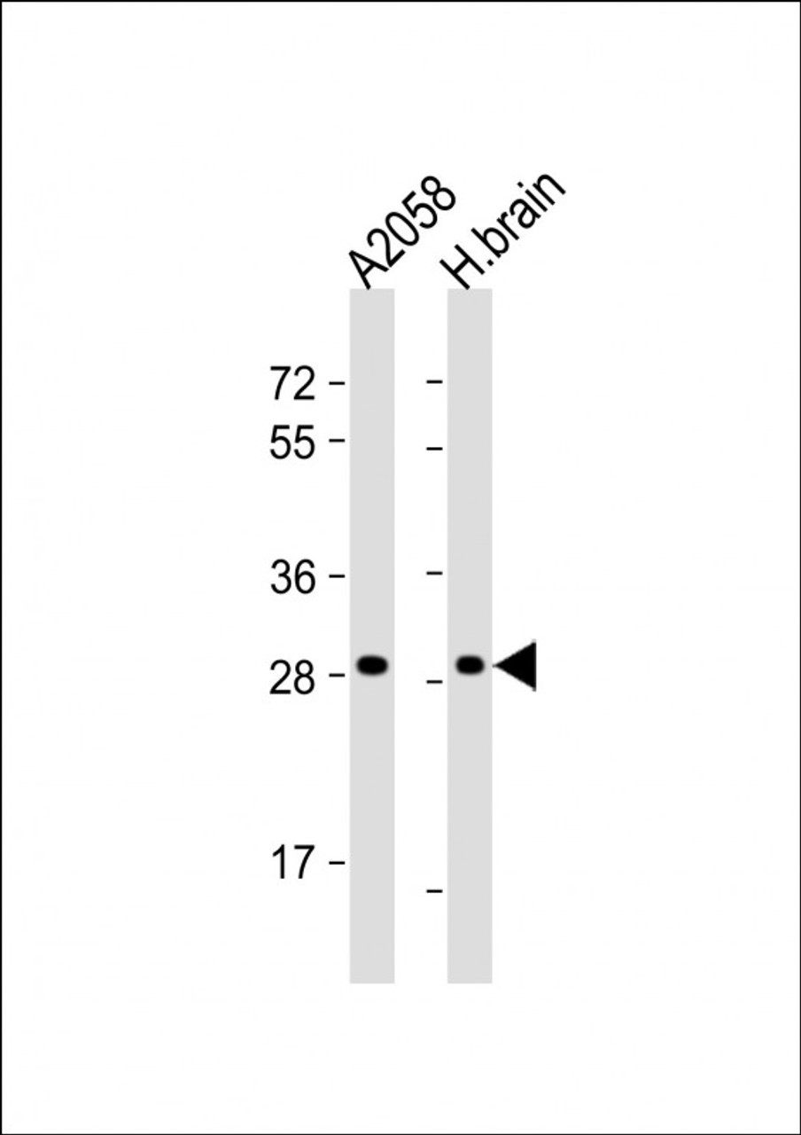 Western Blot at 1:1000 dilution Lane 1: A2058 whole cell lysate Lane 2: human brain lysate Lysates/proteins at 20 ug per lane.