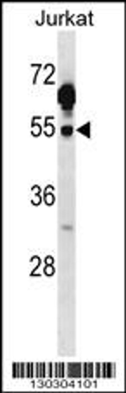 Western blot analysis in Jurkat cell line lysates (35ug/lane) .This demonstratedetected the Csk protein (arrow) .