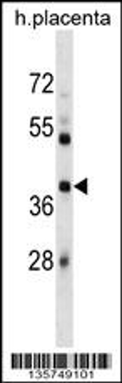 Western blot analysis in human placenta tissue lysates (35ug/lane) .