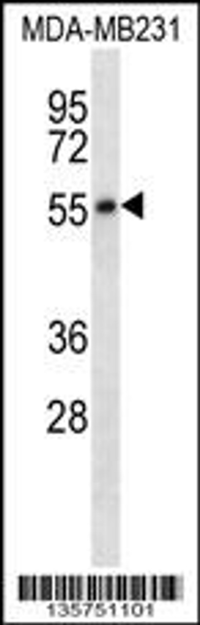 Western blot analysis in MDA-MB231 cell line lysates (35ug/lane) .