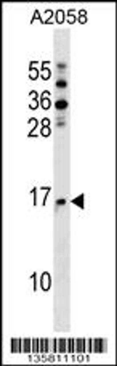 Western blot analysis in A2058 cell line lysates (35ug/lane) .