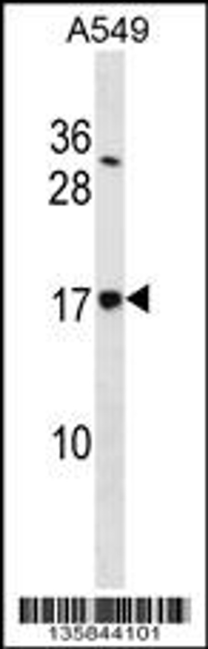 Western blot analysis in A549 cell line lysates (35ug/lane) .