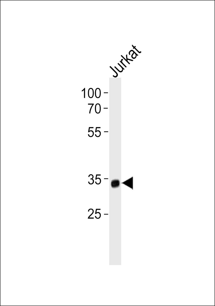 Western blot analysis in Jurkat cell line lysates (35ug/lane) .