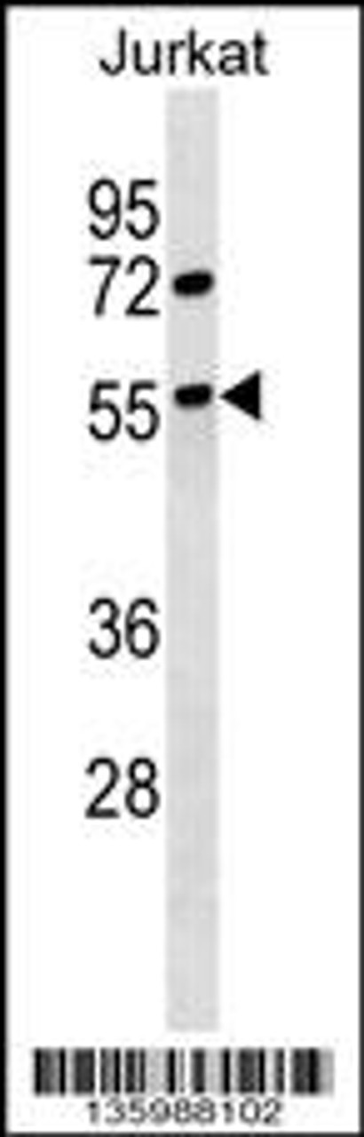 Western blot analysis in Jurkat cell line lysates (35ug/lane) .