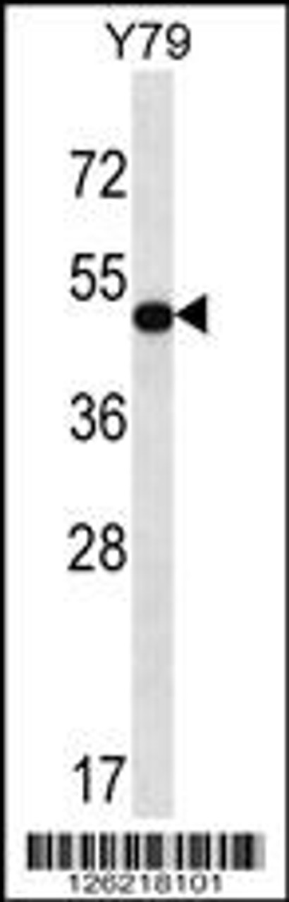 Western blot analysis in Y79 cell line lysates (35ug/lane) .