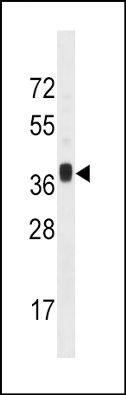 Western blot analysis in mouse liver tissue lysates (35ug/lane) .