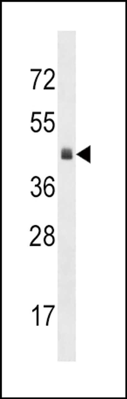 Western blot analysis in mouse heart tissue lysates (35ug/lane) .